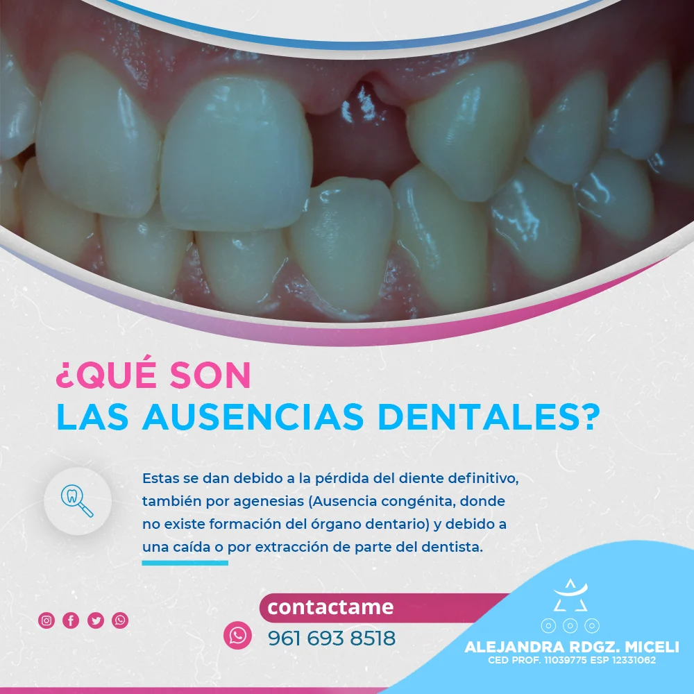 Diseño educativo para redes sociales sobre agenesia dental para la Dra. Alejandra Rodríguez Miceli