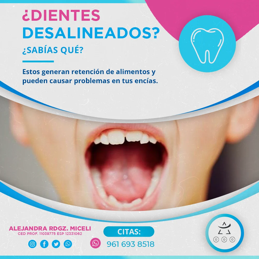 Diseño educativo dental para redes sociales sobre dientes desalineados